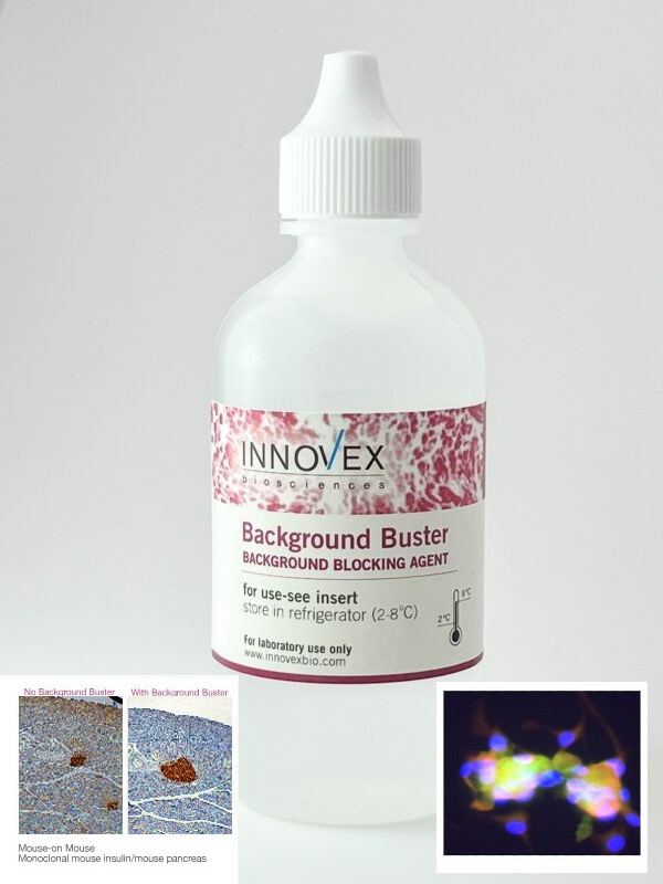 BACKGROUND BUSTER (BB)   Ready-To-Use