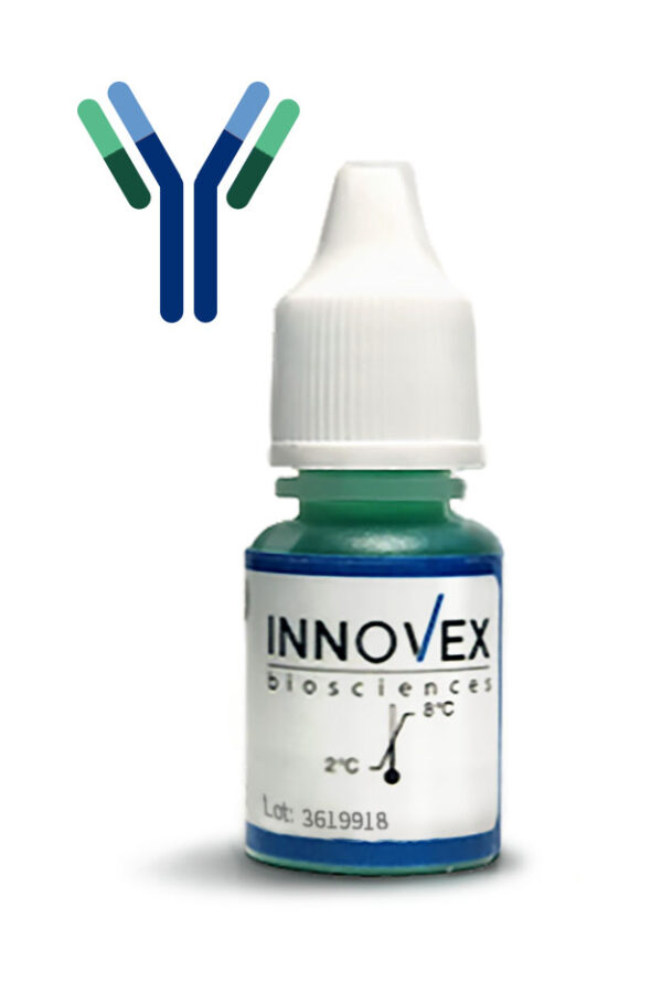 ACTH (Adrenocorticotrophic Hormone) antibody- Ready -To-Use