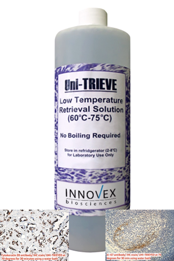 UNI-TRIEVE; Ready-To-Use